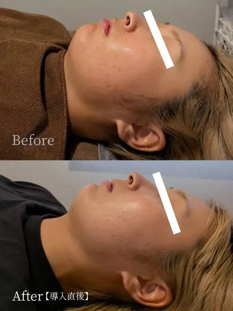 Before and After 2